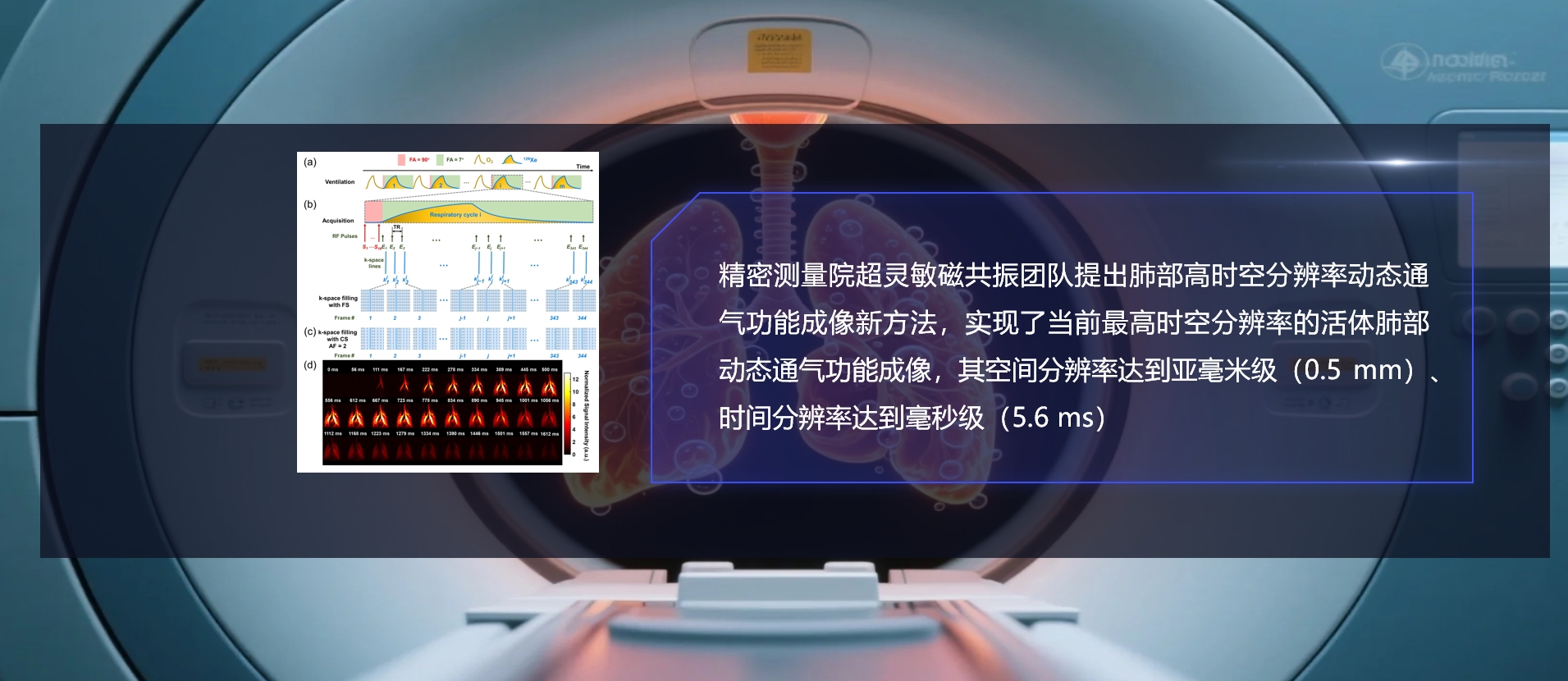 精密测量院提出肺部高时空分辨率动态通气功能成像新方法